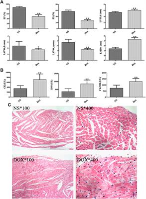 Exploration the Mechanism of Doxorubicin-Induced Heart Failure in Rats by Integration of Proteomics and Metabolomics Data